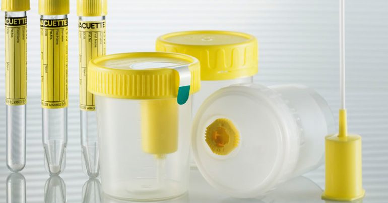 Check-up: cinco exames para o homem fazer no começo do ano | Blog